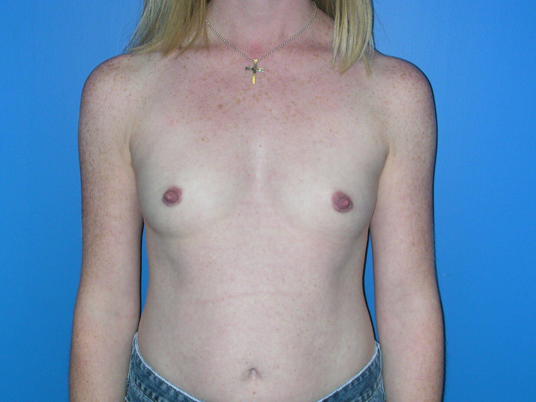 Before Image