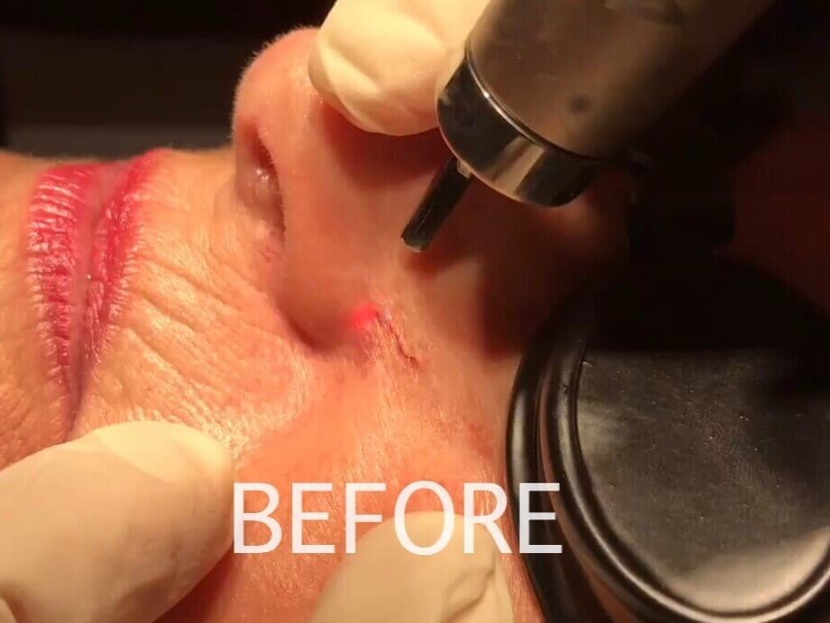 Before Image