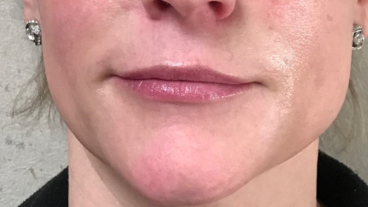 Before Image