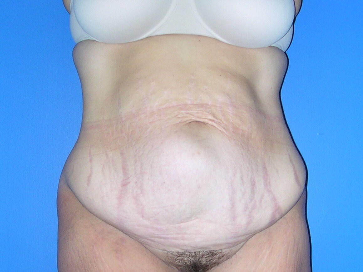 Before Image