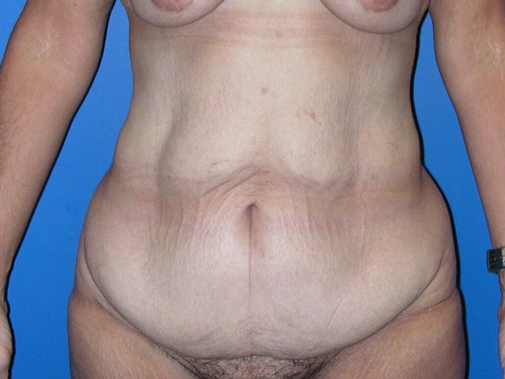 Before Image