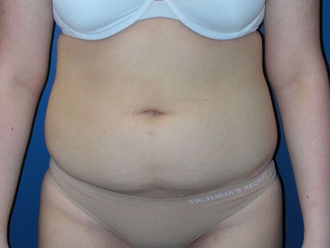 Before Image