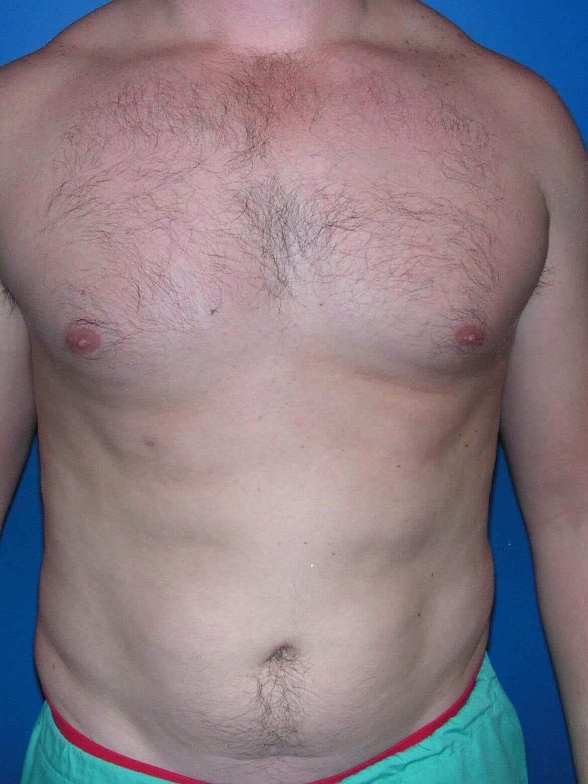 Before Image