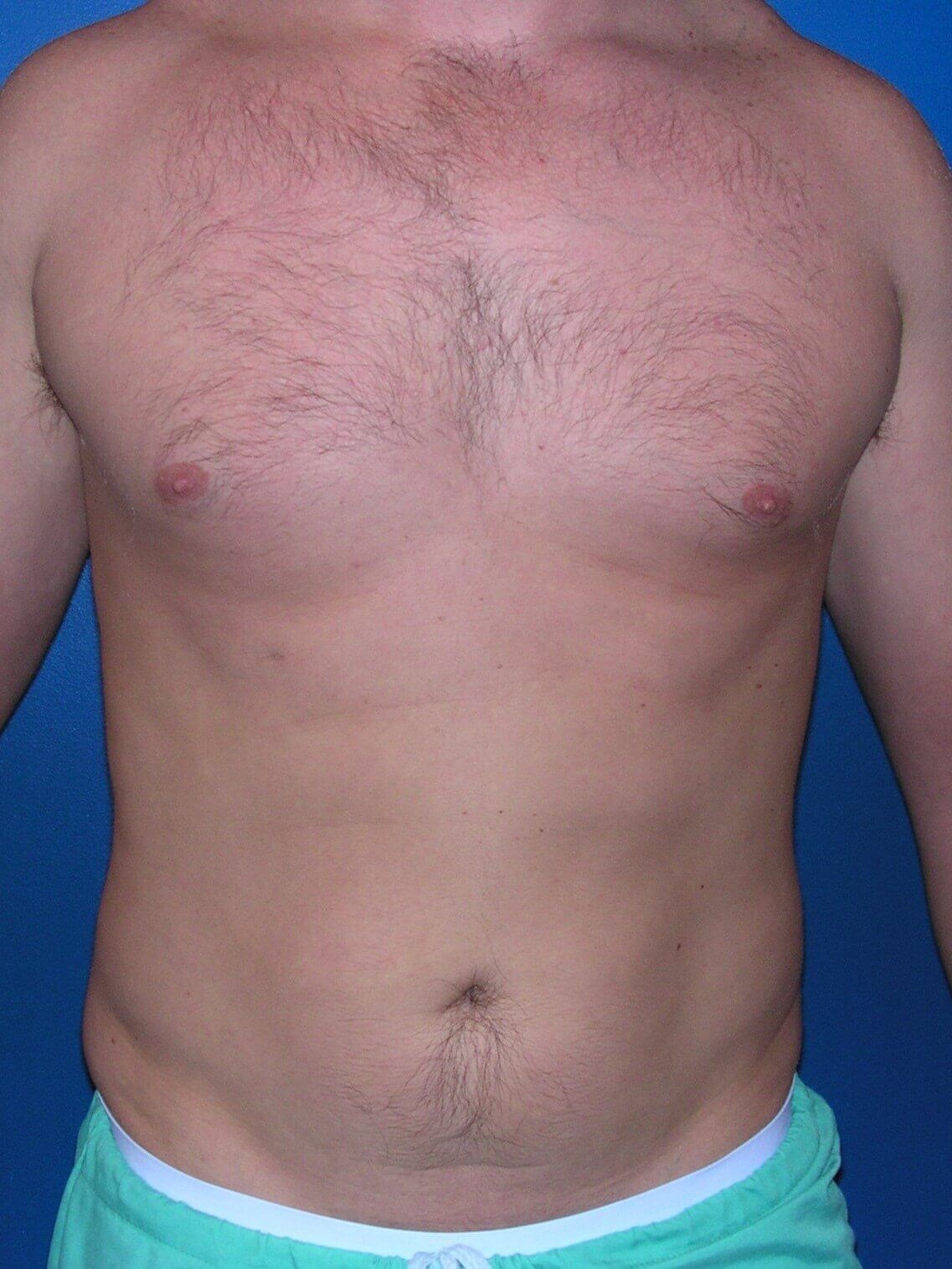 After Image