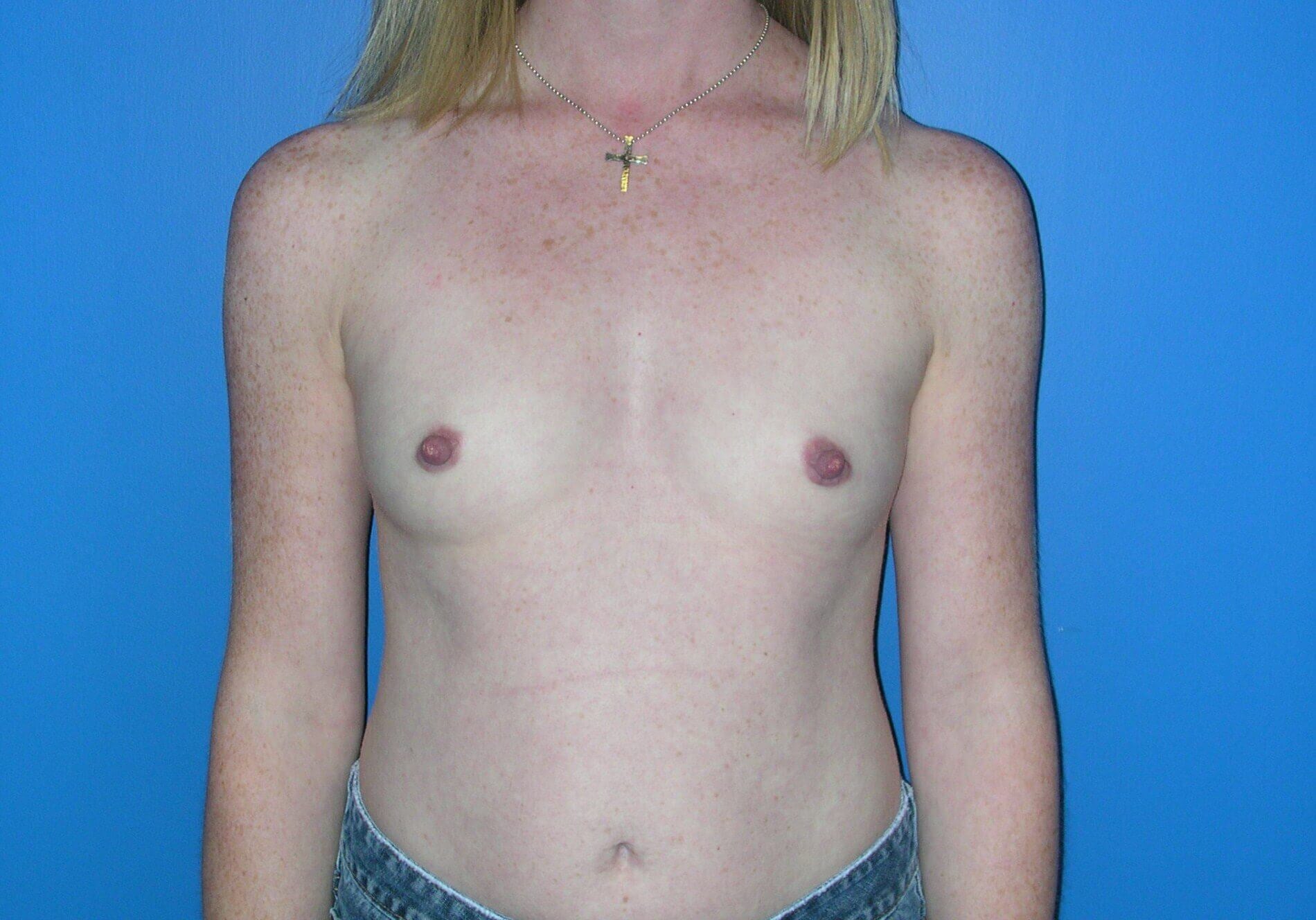 Before Image