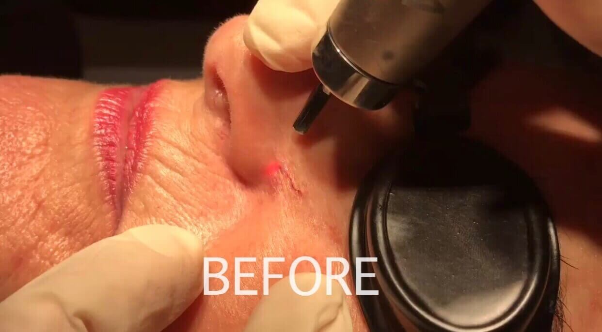 Before Image