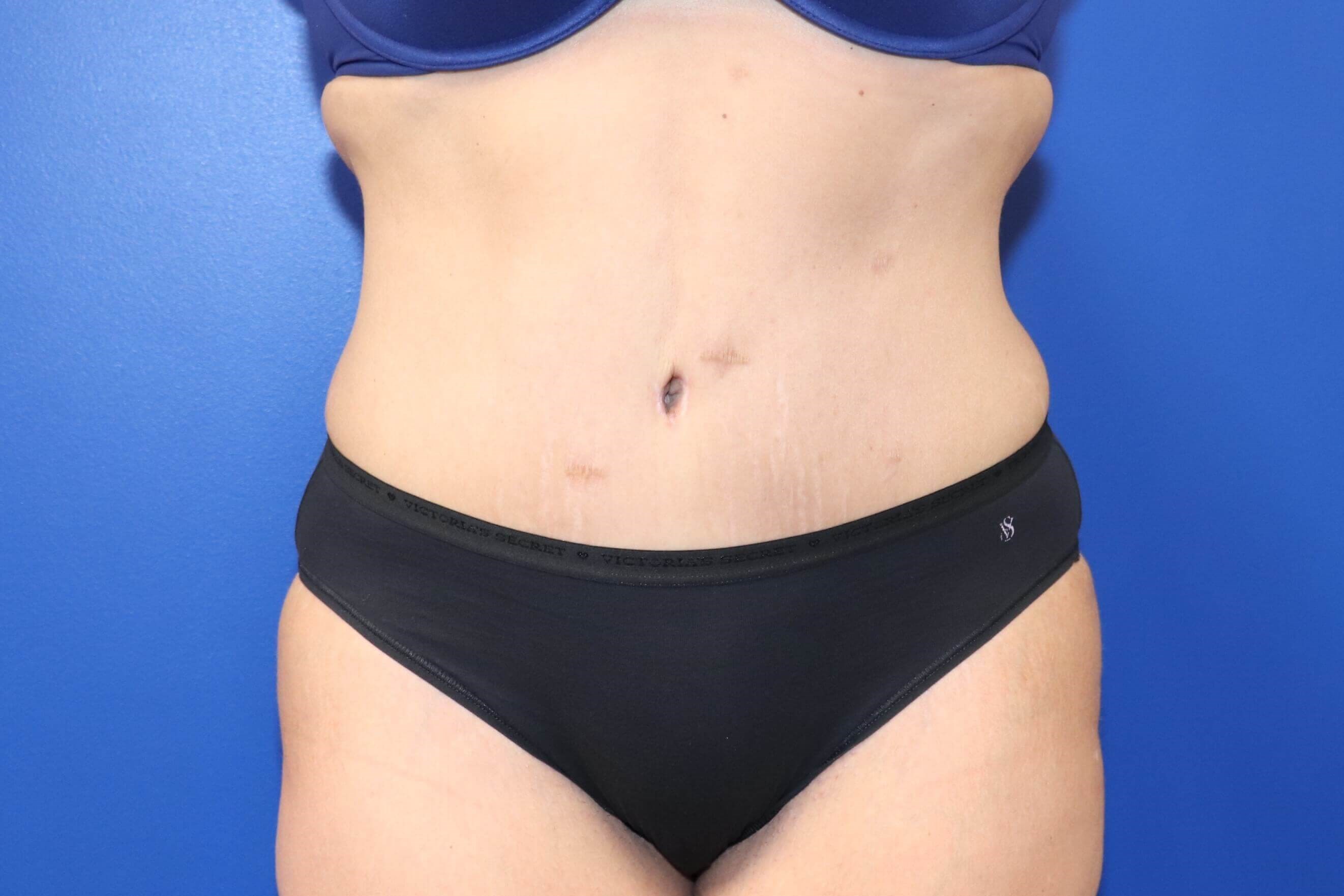 After Image