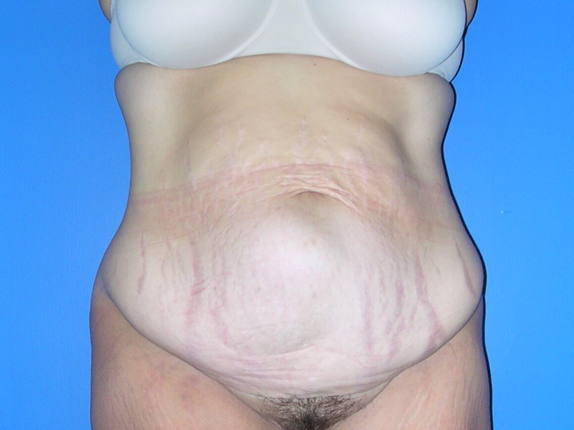 Before Image
