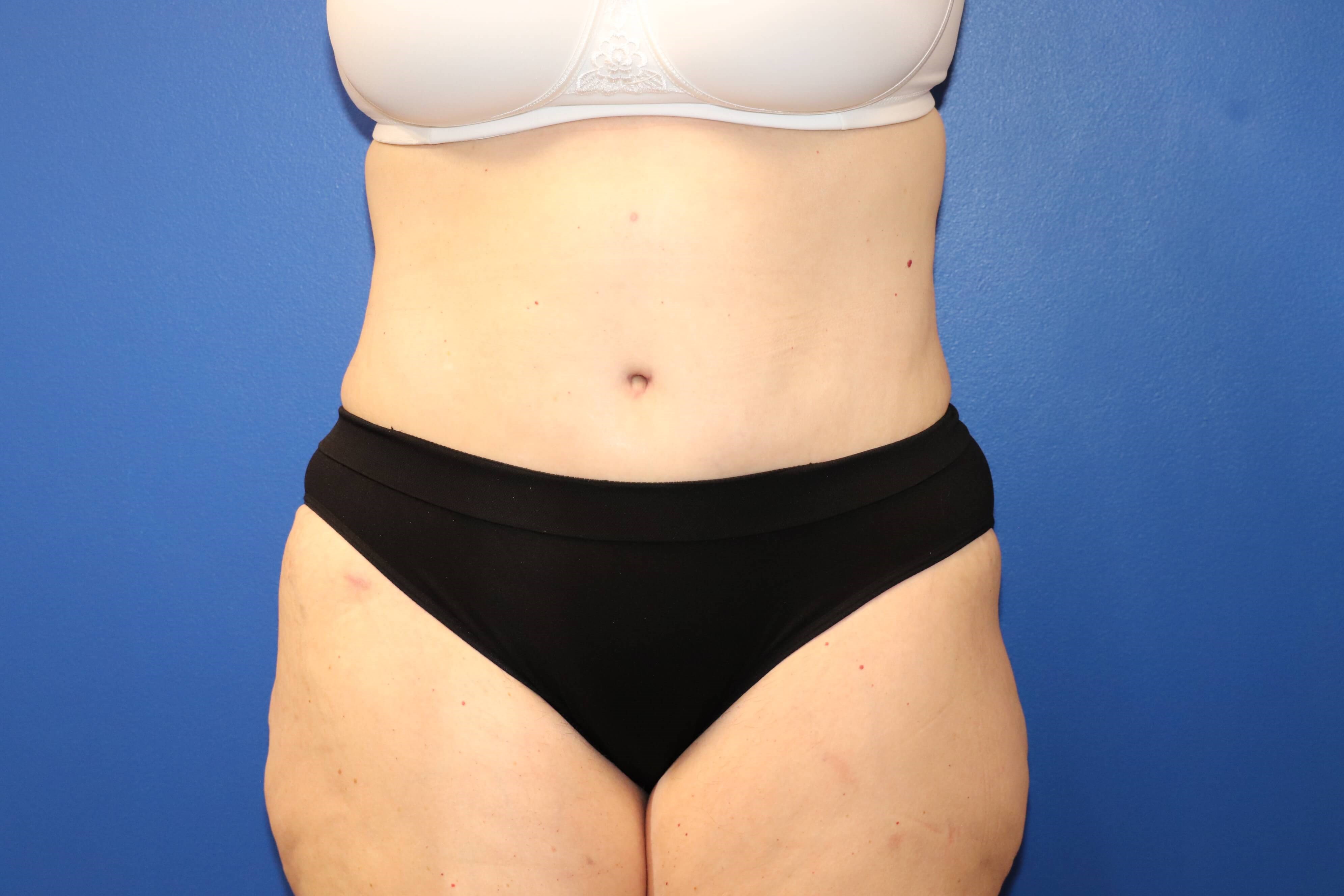 After Image